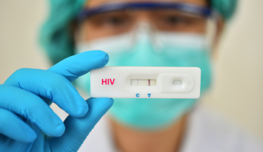 Diagnóstico errôneo HIV